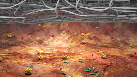 Graphic image of bacteria and wound dressing
