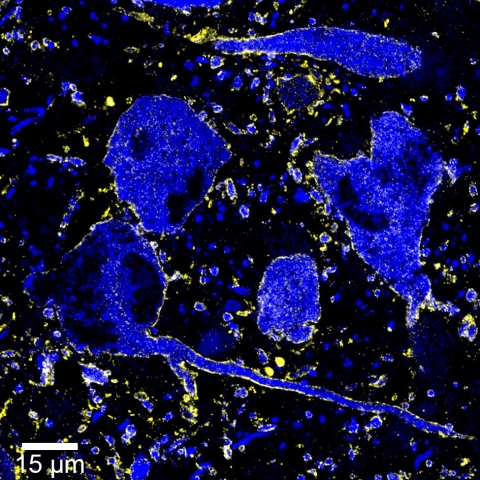 Magnified image of Locus coeruleus nerves cells (blue) expressing the alpha 3 GABA-A receptor (yellow) (2)