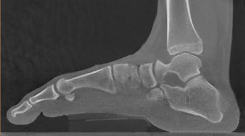 CT scan image of human foot