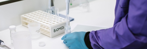 Person preparing a sample with a pipette