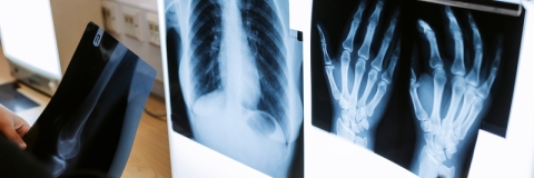 X-rays displayed on a lightbox