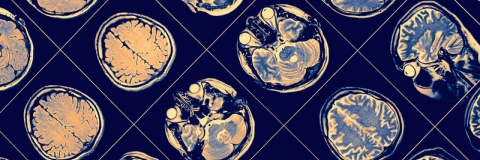 MRI scan, close-up