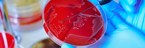 Fungal cultures in a petri dish in microbiology lab